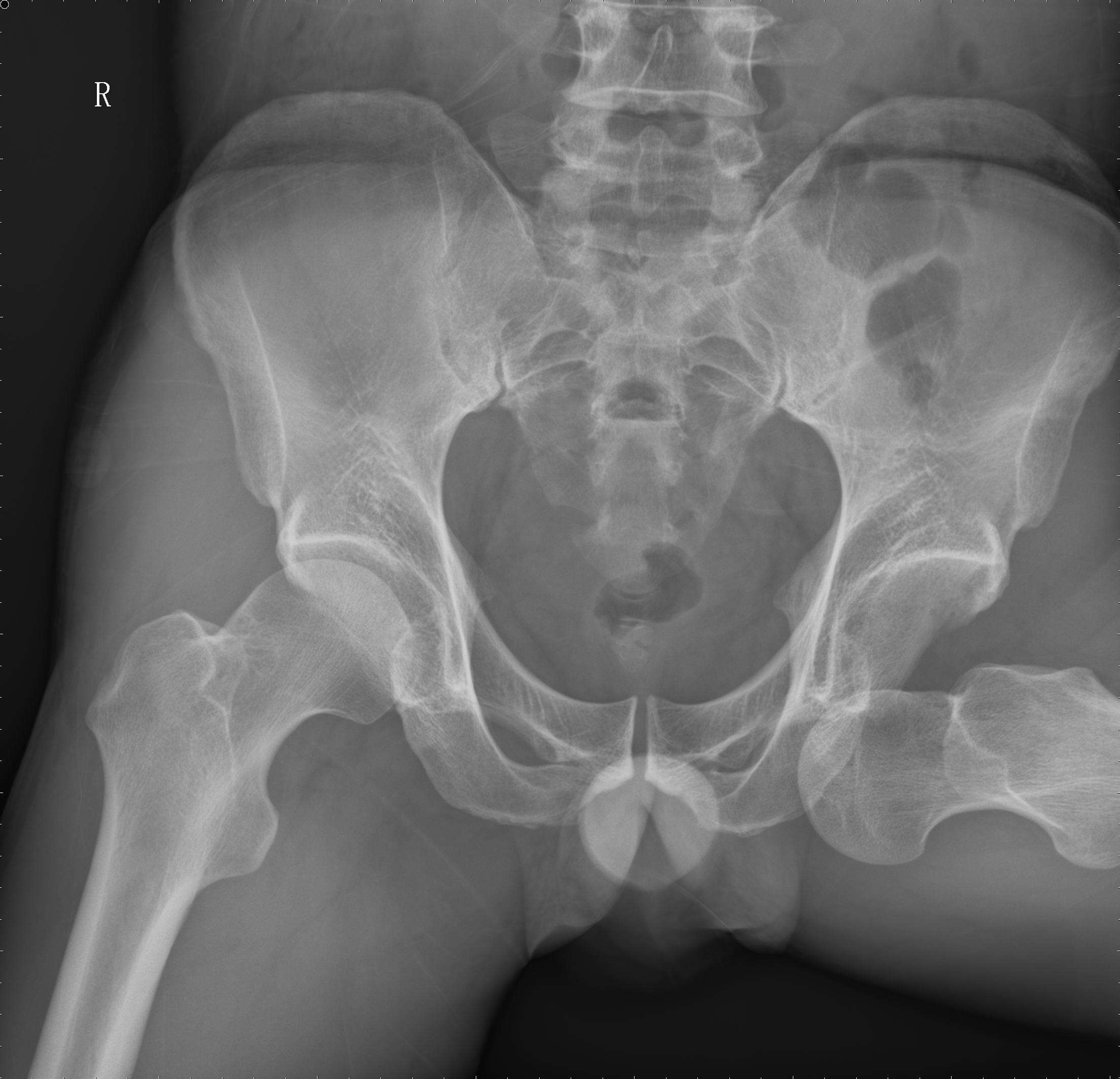 點擊查看大圖 點擊查看大圖