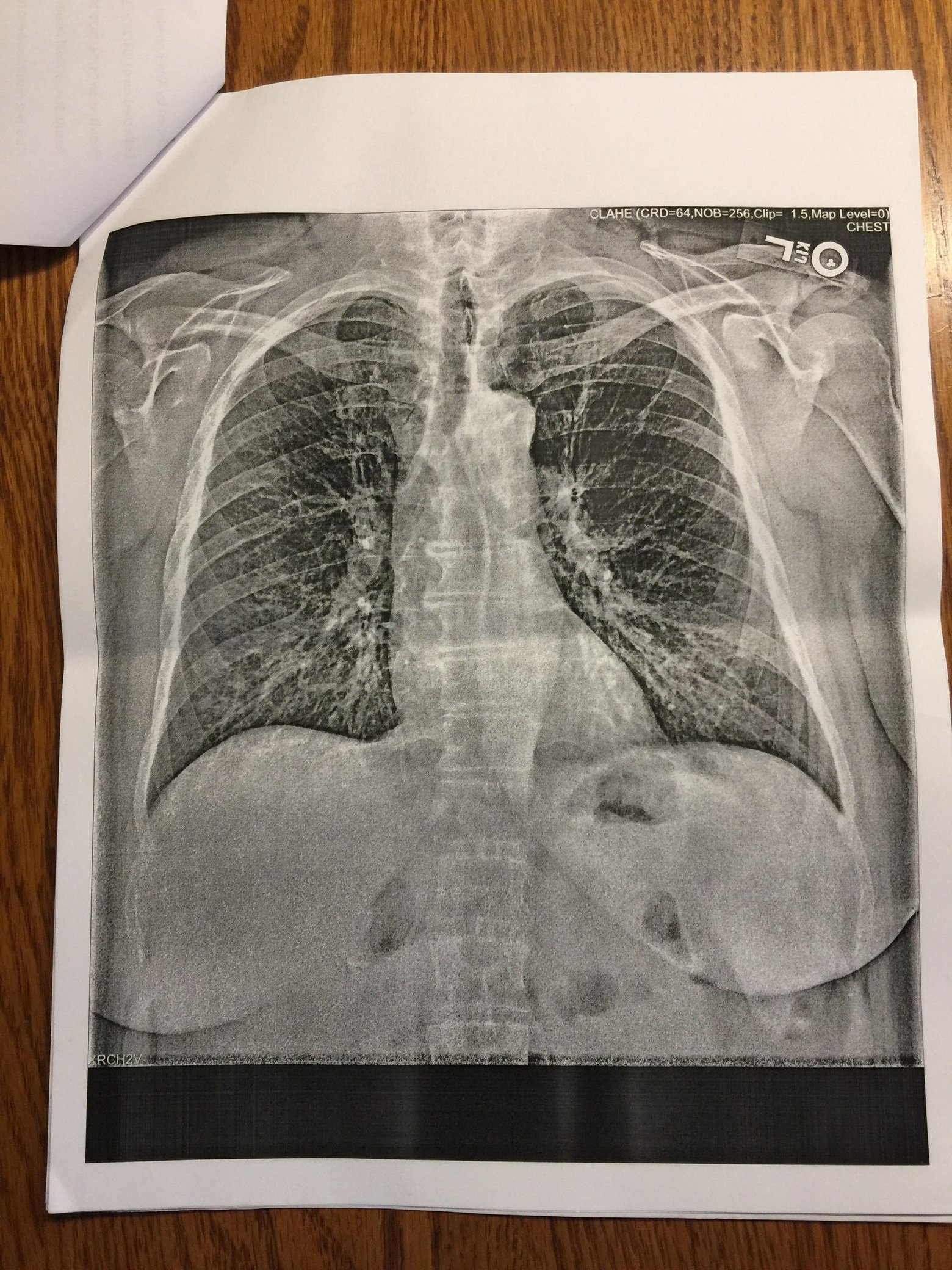 點擊查看大圖 點擊查看大圖